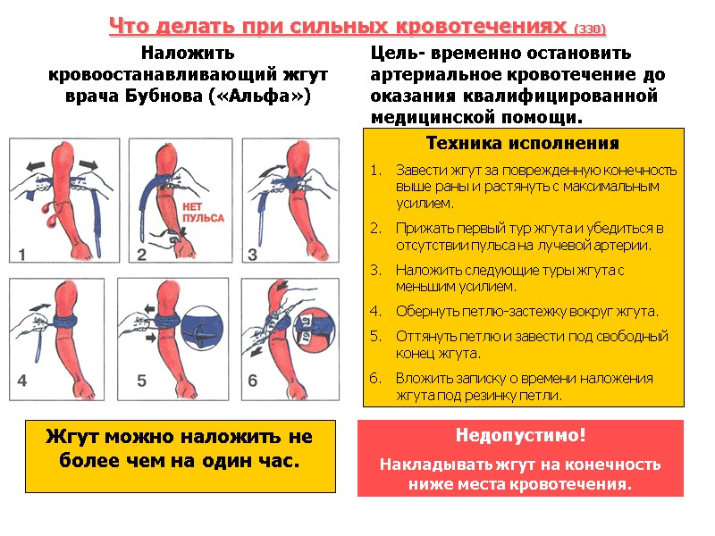 Что делать при сильных кровотечениях (330) Наложить кровоостанавливающий жгут врача Бубнова («Альфа»)  Цель-